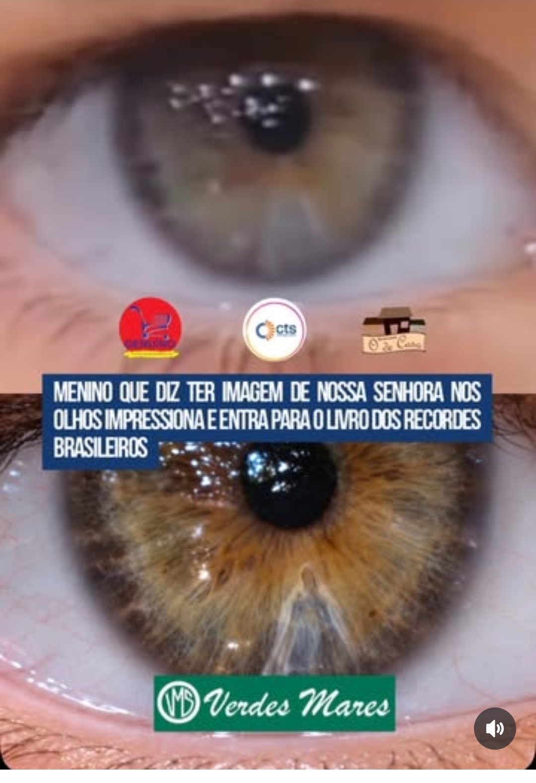 olho